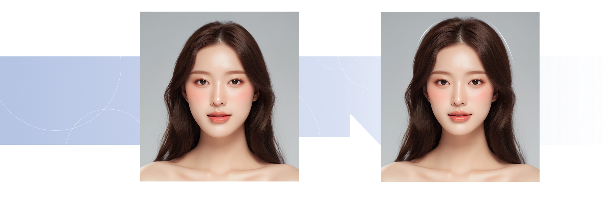 귀필러 시술 전후 비교